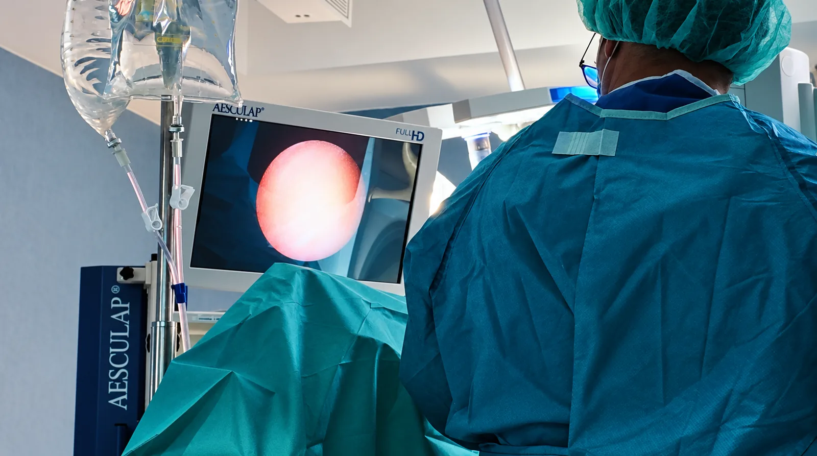 Procedimiento de ureterorrenoscopia para tratar una litiasis urinaria en quirófano